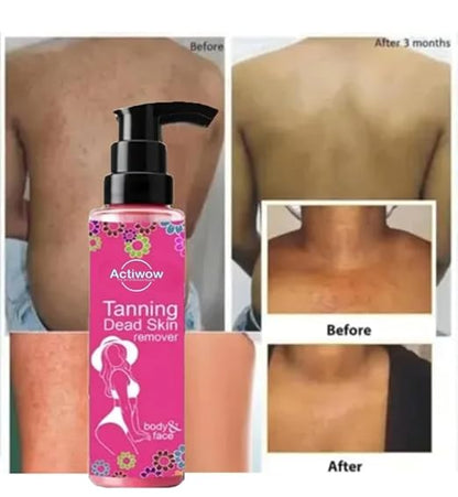 Tanning & Dead Skin Remover